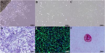 The Effects of Inorganic Phosphorus Levels on Phosphorus Utilization, Local Bone-Derived Regulators, and BMP/MAPK Pathway in Primary Cultured Osteoblasts of Broiler Chicks